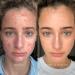 Shop Dr. Barbara Sturm Clarifying Face Cream - 1.69 oz/ 50 mL Online - Best Price & International Shipping - Buy Online on GoSupps.com