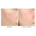 Shop Dr. Brandt Skincare Dark Spots No More Triple Acid Spot Minimizing Concentrate - 0.5 oz/ 15 mL Online - Best Price & International Shipping - Buy Online on GoSupps.com