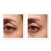 Shop Murad Retinol Youth Renewal Eye Serum - 0.5 oz/ 15 mL Online - Best Price & International Shipping - Buy Online on GoSupps.com