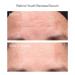 Shop Murad Youth Renewal Retinol Trial Kit for Smoother Younger-Looking Skin Online - Best Price & International Shipping - Buy Online on GoSupps.com