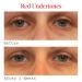 Shop Murad Vitamin C Dark Circle Correcting Eye Serum - 0.5 oz/ 15 mL Online - Best Price & International Shipping - Buy Online on GoSupps.com