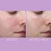 Shop Kate Somerville DeliKate Recovery Serum - 1 oz/ 30 mL Online - Best Price & International Shipping - Buy Online on GoSupps.com