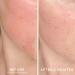 Shop Dr. Brandt Skincare Cool Biotic Prebiotic Redness Relief Cream - 1.7 oz/ 48 g Online - Best Price & International Shipping - Buy Online on GoSupps.com
