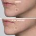Shop First Aid Beauty FAB Pharma BHA Acne Spot Treatment Gel 2% Salicylic Acid Online - Best Price & International Shipping - Buy Online on GoSupps.com