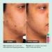 Shop iNNBEAUTY PROJECT Green Machine Vitamin C Dark Spot & Hyperpigmentation Serum - 1 oz/ 30 mL Online - Best Price & International Shipping - Buy Online on GoSupps.com