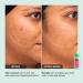Shop iNNBEAUTY PROJECT Green Machine Vitamin C Dark Spot & Hyperpigmentation Serum - 1 oz/ 30 mL Online - Best Price & International Shipping - Buy Online on GoSupps.com