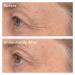 Shop Murad Retinol Youth Renewal Eye Masks - 5 Pairs Online - Best Price & International Shipping - Buy Online on GoSupps.com