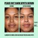 Shop Peace Out Dark Spots Serum - 1 oz/ 30 mL Online - Best Price & International Shipping - Buy Online on GoSupps.com