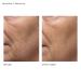 Shop Dr. Dennis Gross Skincare Alpha Beta Daily Moisturizer - 1.7 oz/ 50 mL Online - Best Price & International Shipping - Buy Online on GoSupps.com