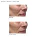 Shop Dr. Dennis Gross Skincare Alpha Beta Daily Moisturizer - 1.7 oz/ 50 mL Online - Best Price & International Shipping - Buy Online on GoSupps.com