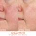 Shop Dr. Dennis Gross Skincare Vitamin C Lactic 15% Firm & Bright Serum - 1 oz / 30 mL Online - Best Price & International Shipping - Buy Online on GoSupps.com