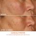 Shop Dr. Dennis Gross Skincare Vitamin C Lactic 15% Firm & Bright Serum - 1 oz / 30 mL Online - Best Price & International Shipping - Buy Online on GoSupps.com