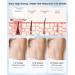 INNZA Laser Hair Removal with Ice Cooling for Women - Professional at-home hair removal system - Buy Online on GoSupps.com