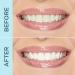 Shop tarte Pearly Girl Vegan Teeth Whitening Pen - 0.135 oz/ 4 mL Online - Best Price & International Shipping - Buy Online on GoSupps.com
