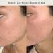 Shop Moon Juice Acid Potion AHA + BHA Resurfacing Exfoliator - 3.3 oz/ 100 mL Online - Best Price & International Shipping - Buy Online on GoSupps.com