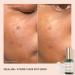 Shop Biossance Squalane + 10% Vitamin C Dark Spot Serum - 1.0 oz/ 30 mL Online - Best Price & International Shipping - Buy Online on GoSupps.com
