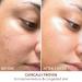 Shop Dr. Dennis Gross Skincare Advanced Retinol + Ferulic Texture Renewal Serum - 1 oz/ 30 mL Online - Best Price & International Shipping - Buy Online on GoSupps.com