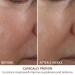Shop Dr. Dennis Gross Skincare Advanced Retinol + Ferulic Overnight Wrinkle Treatment - 1 oz/ 30 mL Online - Best Price & International Shipping - Buy Online on GoSupps.com