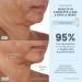 Shop NuFACE Trinity + Wrinkle Reducer Attachment Online - Best Price & International Shipping - Buy Online on GoSupps.com
