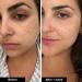 Shop iNNBEAUTY PROJECT Retinol Remix 1% Retinol Treatment With Peptide & Tranexamic Acid Online - Best Price & International Shipping - Buy Online on GoSupps.com