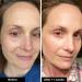 Shop iNNBEAUTY PROJECT Retinol Remix 1% Retinol Treatment With Peptide & Tranexamic Acid Online - Best Price & International Shipping - Buy Online on GoSupps.com