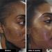 Shop iNNBEAUTY PROJECT Retinol Remix 1% Retinol Treatment With Peptide & Tranexamic Acid Online - Best Price & International Shipping - Buy Online on GoSupps.com