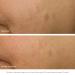 Shop goop GOOPGLOW Exfoliating Dark Spot Sleep Serum - 1 oz / 30 mL Online - Best Price & International Shipping - Buy Online on GoSupps.com