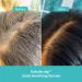 Shop Fable & Mane SahaScalp Scalp Reset Kit Online - Best Price & International Shipping - Buy Online on GoSupps.com