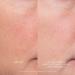 Shop Hourglass Equilibrium Resurfacing Retinoid Treatment - 1 oz / 30 mL Online - Best Price & International Shipping - Buy Online on GoSupps.com