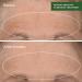 Shop Murad Retinal ReSculpt Overnight Treatment - 1 oz / 30 mL Online - Best Price & International Shipping - Buy Online on GoSupps.com