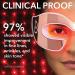 Shop Dr. Dennis Gross Skincare DRx SpectraLite LED EyeCare Max Pro Online - Best Price & International Shipping - Buy Online on GoSupps.com