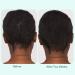 Shop Nutrafol Strand Defender Lightweight Strengthening Conditioner for Thinning Hair - 8.1 oz / 240 mL Online - Best Price & International Shipping - Buy Online on GoSupps.com
