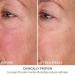 Shop Dr. Dennis Gross Skincare DermInfusions Fill + Repair Serum with Hyaluronic Acid - 1 oz / 30 mL Online - Best Price & International Shipping - Buy Online on GoSupps.com