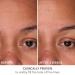 Shop Dr. Dennis Gross Skincare DermInfusions Fill + Repair Serum with Hyaluronic Acid - 1 oz / 30 mL Online - Best Price & International Shipping - Buy Online on GoSupps.com