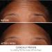 Shop Dr. Dennis Gross Skincare DermInfusions Fill + Repair Serum with Hyaluronic Acid - 1 oz / 30 mL Online - Best Price & International Shipping - Buy Online on GoSupps.com