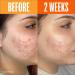 Shop Lion Pose UNSPOTTED 4X Dark Spot + Hyperpigmentation AHA Serum - 1 oz / 30 ml Online - Best Price & International Shipping - Buy Online on GoSupps.com