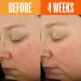 Shop Lion Pose UNSPOTTED 4X Dark Spot + Hyperpigmentation AHA Serum - 1 oz / 30 ml Online - Best Price & International Shipping - Buy Online on GoSupps.com