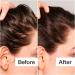 Shop Act+Acre Salicylic Acid Scalp Renew Exfoliator For Oily + Flakey Scalp - 2 oz / 60 ml Online - Best Price & International Shipping - Buy Online on GoSupps.com