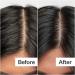 Shop Act+Acre Salicylic Acid Scalp Renew Exfoliator For Oily + Flakey Scalp - 2 oz / 60 ml Online - Best Price & International Shipping - Buy Online on GoSupps.com