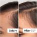 Shop Act+Acre 0.25mm Scalp Dermaroller for Thicker + Fuller Looking Hair - Standard size Online - Best Price & International Shipping - Buy Online on GoSupps.com
