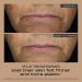 Shop MATTER OF FACT MAXIMALIST AGE-DEFYING RICH MOISTURIZER with 4% Peptide & Hyaluronic Acid Blend - 1.6 oz Online - Best Price & International Shipping - Buy Online on GoSupps.com