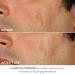 Shop Dr. Dennis Gross Skincare Advanced Retinol + Ferulic Perfectly Dosed Retinol Extra Strength 0.5%						 - 8 Treatments / Pack Online - Best Price & International Shipping - Buy Online on GoSupps.com