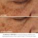 Shop Dr. Dennis Gross Skincare Advanced Retinol + Ferulic Perfectly Dosed Retinol Universal 0.2%						 - 8 Treatments / Pack Online - Best Price & International Shipping - Buy Online on GoSupps.com