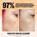 Shop Peace Out 2% Salicylic Acid Acne Gel Cleanser - 4 oz Online - Best Price & International Shipping - Buy Online on GoSupps.com