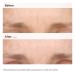 Shop The Ordinary Retinal 0.2% Emulsion Serum - 0.5 oz / 15 ml Online - Best Price & International Shipping - Buy Online on GoSupps.com