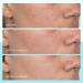 Shop First Aid Beauty Dark Spot Serum with Niacinamide - 1 oz Online - Best Price & International Shipping - Buy Online on GoSupps.com