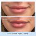 Shop First Aid Beauty Ultra Repair Lip Balm - 0.25 oz / 6 g Online - Best Price & International Shipping - Buy Online on GoSupps.com