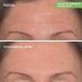 Shop Murad 5 Minute Fix: Targeted Correctors Set Online - Best Price & International Shipping - Buy Online on GoSupps.com