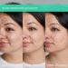 Shop Skinfix acne+ triple threat set with Salicylic Acid (BHA) + Niacinamide with B-L3 Online - Best Price & International Shipping - Buy Online on GoSupps.com