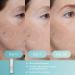 Shop Elemis Dynamic Resurfacing Vitamin C Dark Spot Serum - 0.5 oz / 15 ml Online - Best Price & International Shipping - Buy Online on GoSupps.com